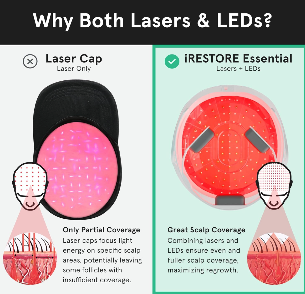 iRestore Essential Laser Red Light Therapy