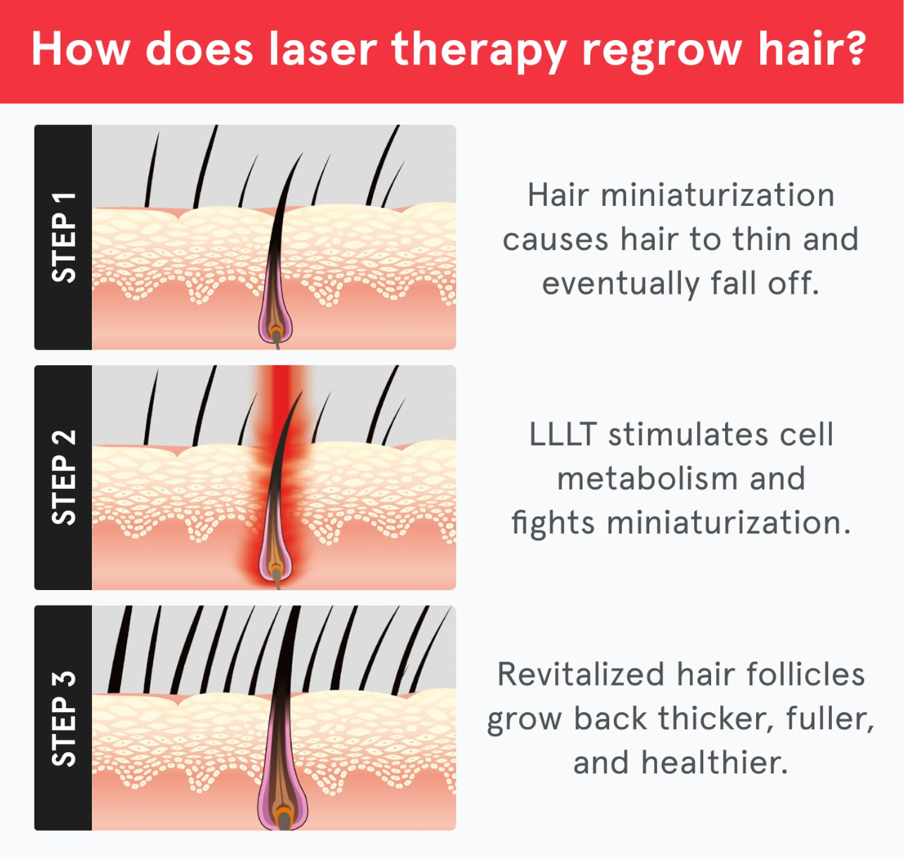 iRestore Essential Laser Red Light Therapy