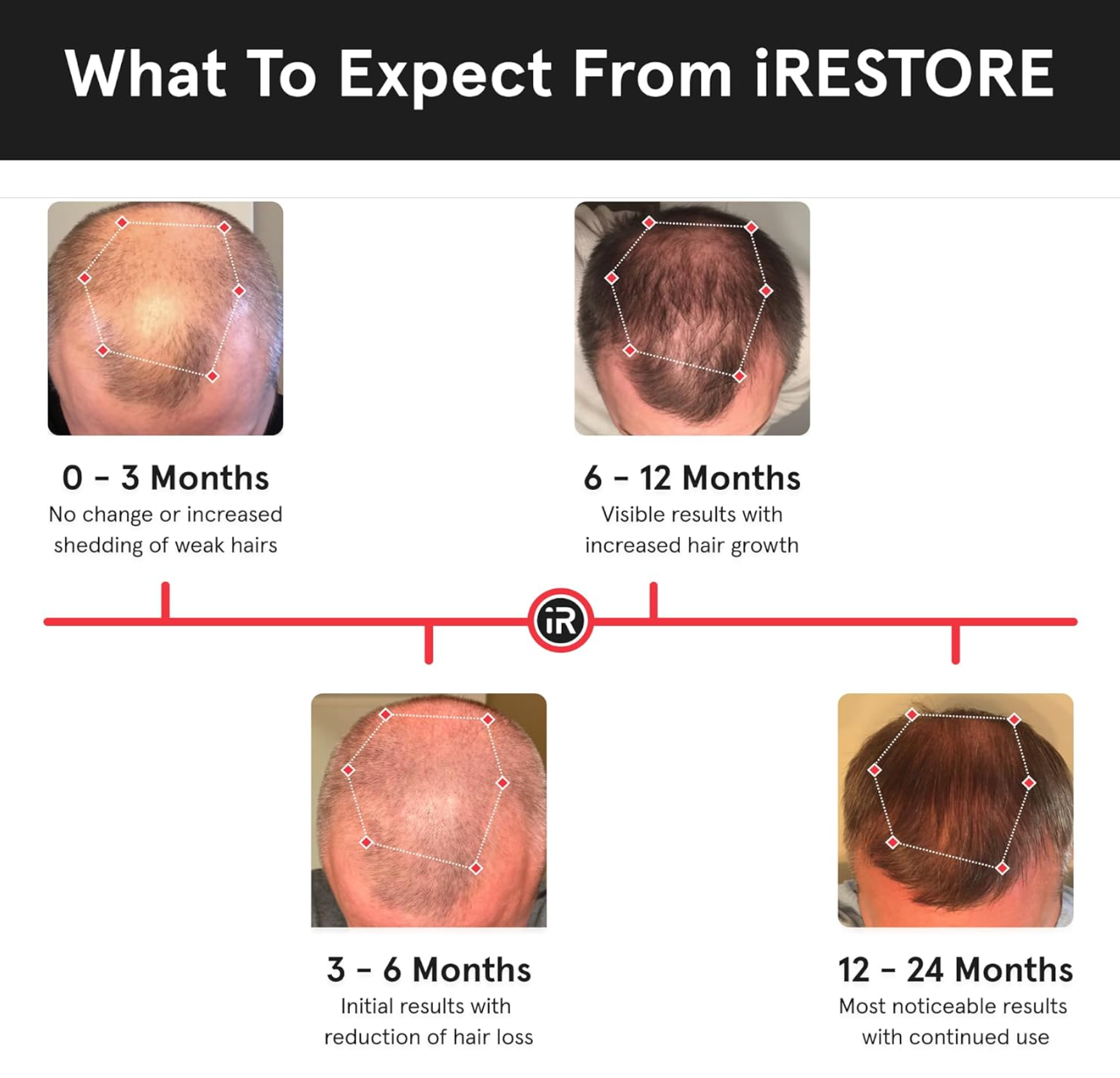 iRestore Essential Laser Red Light Therapy