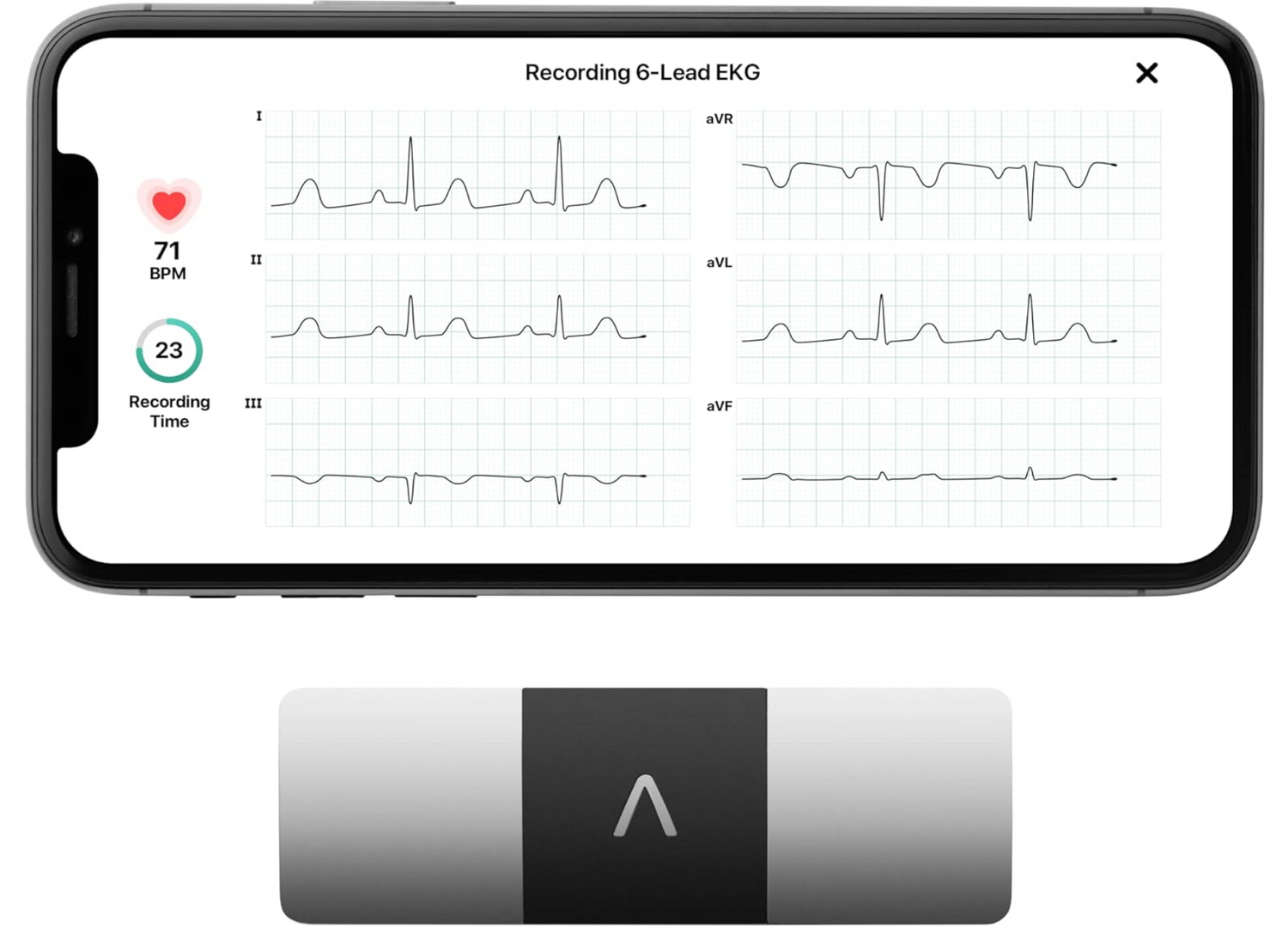 KardiaMobile 6-Lead Personal EKG Monitor